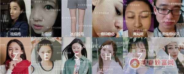 泽十字祛痘加盟